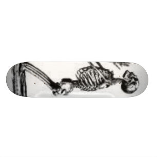 skelet skateboard