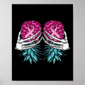 Skelethandbedekking onderaan ananasborst poster (Voorkant)