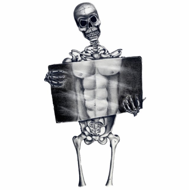 Skeleton Chest Xray Fotosculptuur Staand Fotobeeldje (Voorkant)