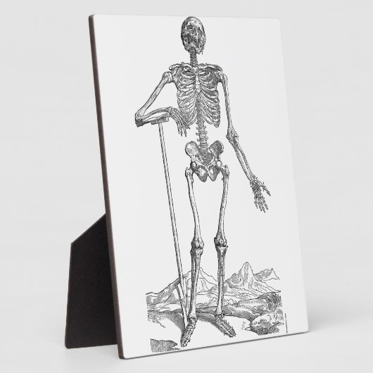 Skeleton Fotoplaat (Zijkant)