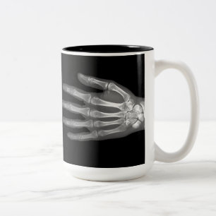 Skeleton Hand X-Ray Tweekleurige Koffiemok