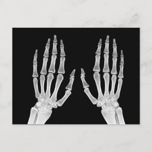 Skeleton Hands Xray Afbeelding Foto van menselijke Briefkaart