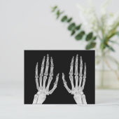 Skeleton Hands Xray Afbeelding Foto van menselijke Briefkaart (Staand voorkant)