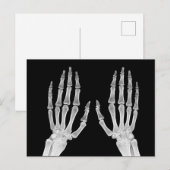 Skeleton Hands Xray Afbeelding Foto van menselijke Briefkaart (Voorkant / Achterkant)