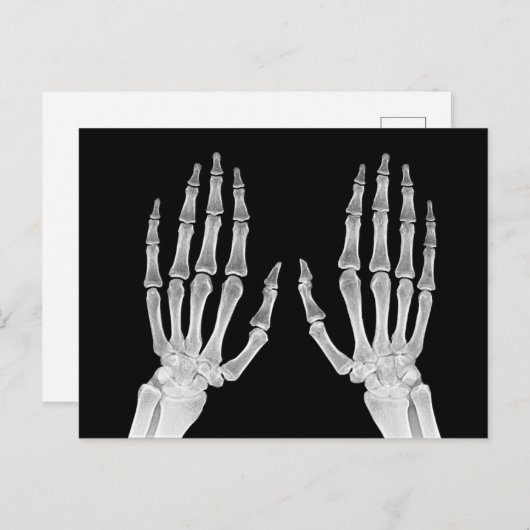 Skeleton Hands Xray Afbeelding Foto van menselijke Briefkaart (Voorkant / Achterkant)