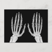 Skeleton Hands Xray Afbeelding Foto van menselijke Briefkaart (Voorkant)