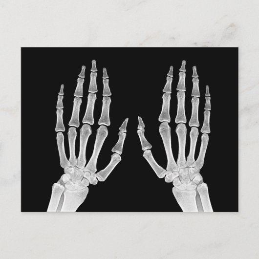 Skeleton Hands Xray Afbeelding Foto van menselijke Briefkaart (Voorkant)