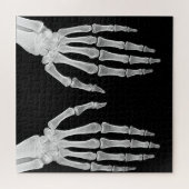 Skeleton Hands Xray Afbeelding Foto van menselijke Legpuzzel (Horizontaal)