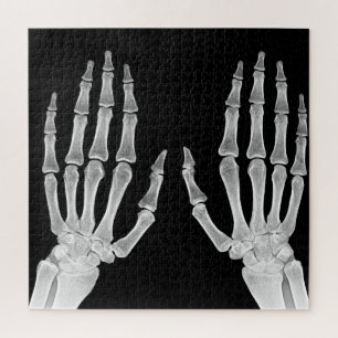 Skeleton Hands Xray Afbeelding Foto van menselijke Legpuzzel