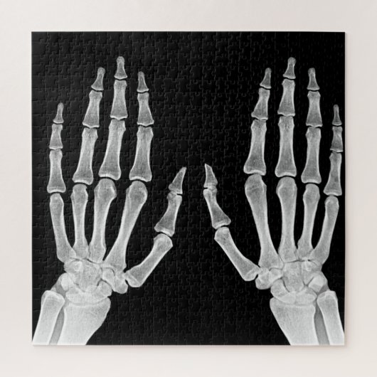 Skeleton Hands Xray Afbeelding Foto van menselijke Legpuzzel (Verticaal)