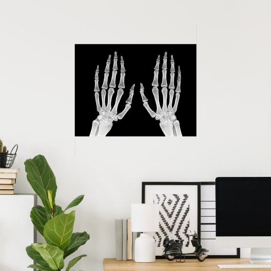 Skeleton Hands Xray Afbeelding Foto van menselijke Poster (Thuiskantoor)