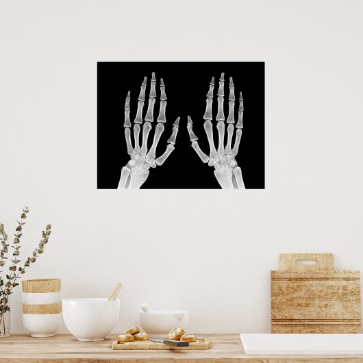Skeleton Hands Xray Afbeelding Foto van menselijke Poster (Keuken)