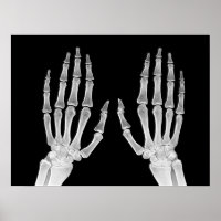 Skeleton Hands Xray Afbeelding Foto van menselijke