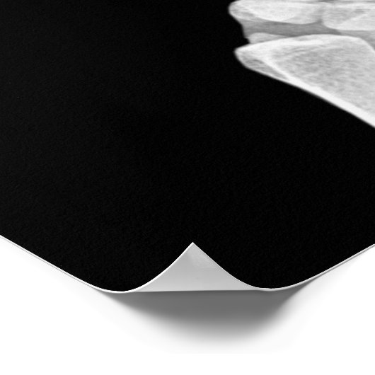Skeleton Hands Xray Afbeelding Foto van menselijke Poster (Hoek)