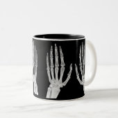 Skeleton Hands Xray Picture Human Anatomy photo Tweekleurige Koffiemok (Voorkant rechts)