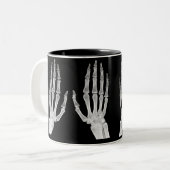Skeleton Hands Xray Picture Human Anatomy photo Tweekleurige Koffiemok (Voorkant links)