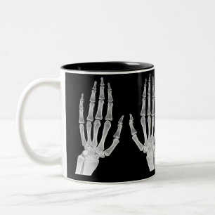 Skeleton Hands Xray Picture Human Anatomy photo Tweekleurige Koffiemok