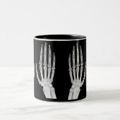 Skeleton Hands Xray Picture Human Anatomy photo Tweekleurige Koffiemok (Center)