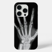 Skeleton iPhone 15 Pro hoes (Achterkant)