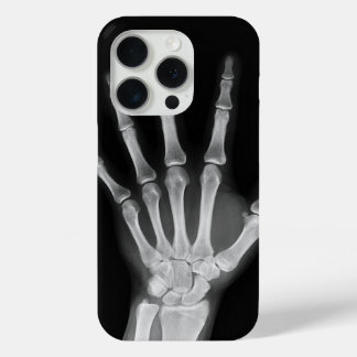Skeleton iPhone 15 Pro hoes