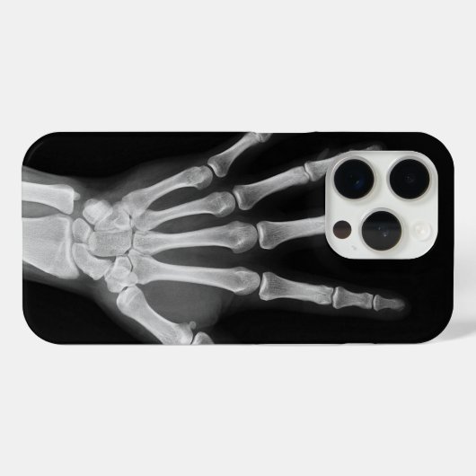 Skeleton iPhone 15 Pro hoes (Achterkant (horizontaal))