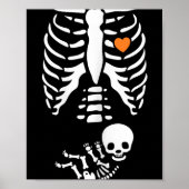 Skeleton Xray Halloween Costume Pregnant Women Mom Poster (Voorkant)