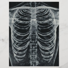 Skeleton Xray Rib kooi zwart wit gothisch