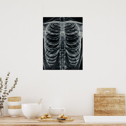Skeleton Xray Rib kooi  zwart wit gothisch Poster (Keuken)