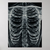 Skeleton Xray Rib kooi  zwart wit gothisch Poster (Voorkant)