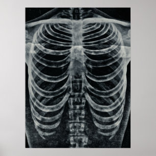 Skeleton Xray Rib kooi  zwart wit gothisch Poster