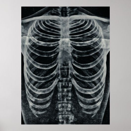 Skeleton Xray Rib kooi  zwart wit gothisch Poster (Voorkant)