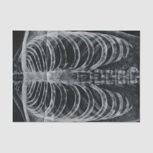 Skeleton Xray Rib kooi  zwart wit gothisch Tissuepapier (Voorkant)