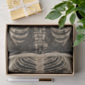 Skeleton Xray Rib Vintage Sepia Black Gothic Tissuepapier (Geschenk)