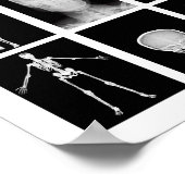 skeletspieren Huid- en onderhuidaandoeningen Poster (Hoek)