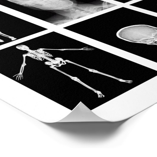 skeletspieren Huid- en onderhuidaandoeningen Poster (Hoek)