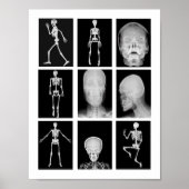 skeletspieren Huid- en onderhuidaandoeningen Poster (Voorkant)