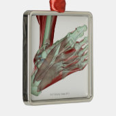 Skeletspierstelsel- en bindweefselaandoeningen metalen ornament (Rechts)