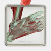 Skeletspierstelsel- en bindweefselaandoeningen metalen ornament (Voorkant)