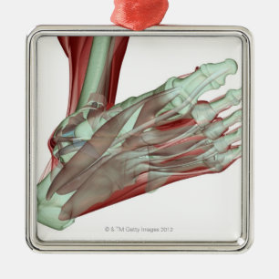 Skeletspierstelsel- en bindweefselaandoeningen metalen ornament