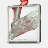 Skeletspierstelsel- en bindweefselaandoeningen metalen ornament (Links)