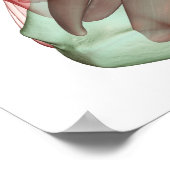 Skeletspierstelsel- en bindweefselaandoeningen poster (Hoek)