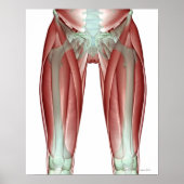 Skeletspierstelsel- en bindweefselaandoeningen poster (Voorkant)