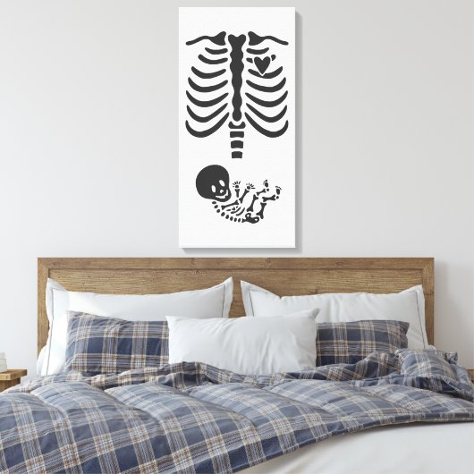 Skeletten Canvas Afdruk (Insitu (Slaapkamer))