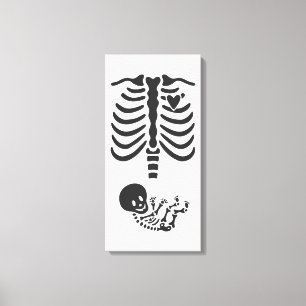 Skeletten Canvas Afdruk