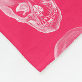 Skull Xray Pink Fleece Blanket (Hoek)