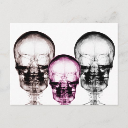 Skulls met gemengde röntgenstraling briefkaart (Voorkant)