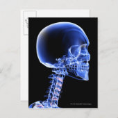 Sluit de röntgenfoto van de botten in de nek briefkaart (Voorkant / Achterkant)