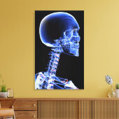 Sluit de röntgenfoto van de botten in de nek canvas afdruk (Insitu (Woonkamer))