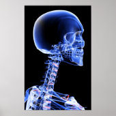 Sluit de röntgenfoto van de botten in de nek poster (Voorkant)