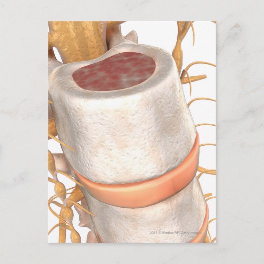 Sluit een ongewervelde schijf in de wervelkolom briefkaart (Voorkant)